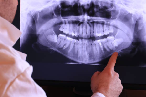 Best Emergency Root Canal Treatment in Oxford, GA