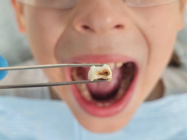 Best Emergency Broken Tooth Repair in Oxford, GA