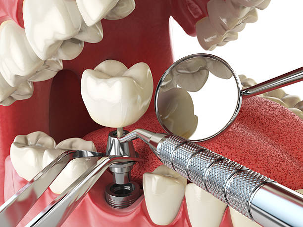 Best Same-Day Emergency Dentist in Oxford, GA