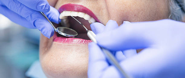 Best Emergency Tooth Extraction in Oxford, GA